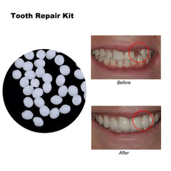 4 Colors Dental Oral False Fake Teeth Tooth Filling Repair Smile Snap on Veneers Dentures Case Paste Adhesive Beads Cosmetic