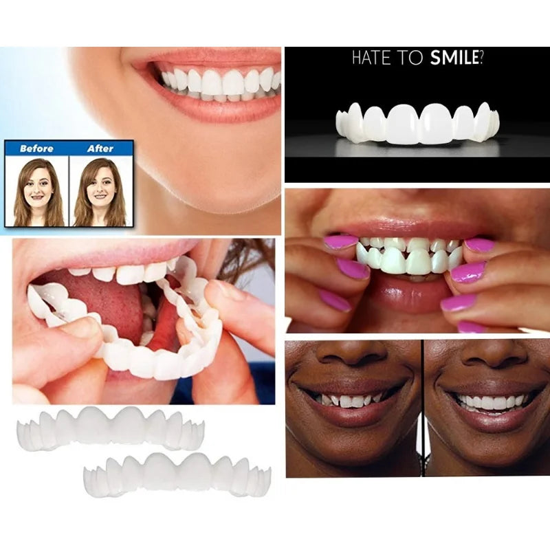 Upper & Lower Teeth Veneers Anti-true Braces Snap On Smile Teeth Whitening  Denture Teeth Comfortable Veneer Cover Teeth