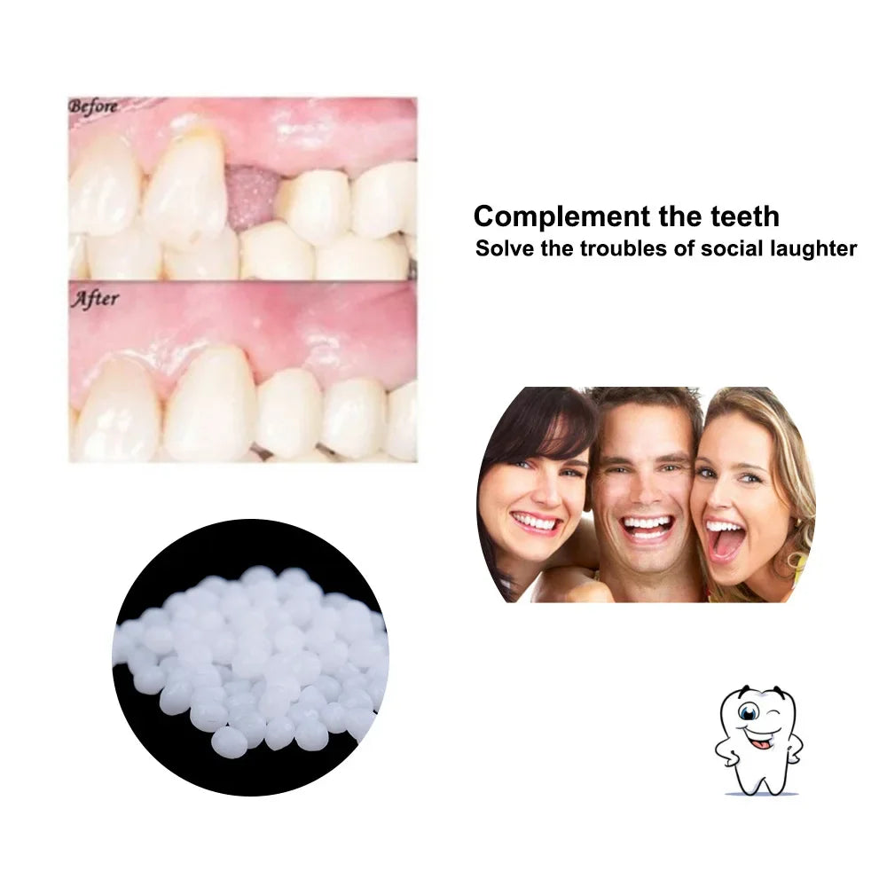 4 Colors Dental Oral False Fake Teeth Tooth Filling Repair Smile Snap on Veneers Dentures Case Paste Adhesive Beads Cosmetic