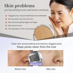 ANLAN Ultrasonic Skin Scrubber Peeling Facial Ultrasonic EMS Face Red Blue Lifting Skin Care Pore Deep Cleansing Machine IPX7