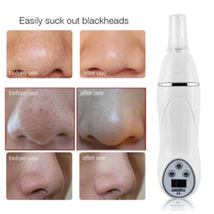 Micro Acne Remover Vacuum Massage Acne Removal Facial Smoothing Cleansing Skincare Drinding Diamond Pen  home beauty equipment