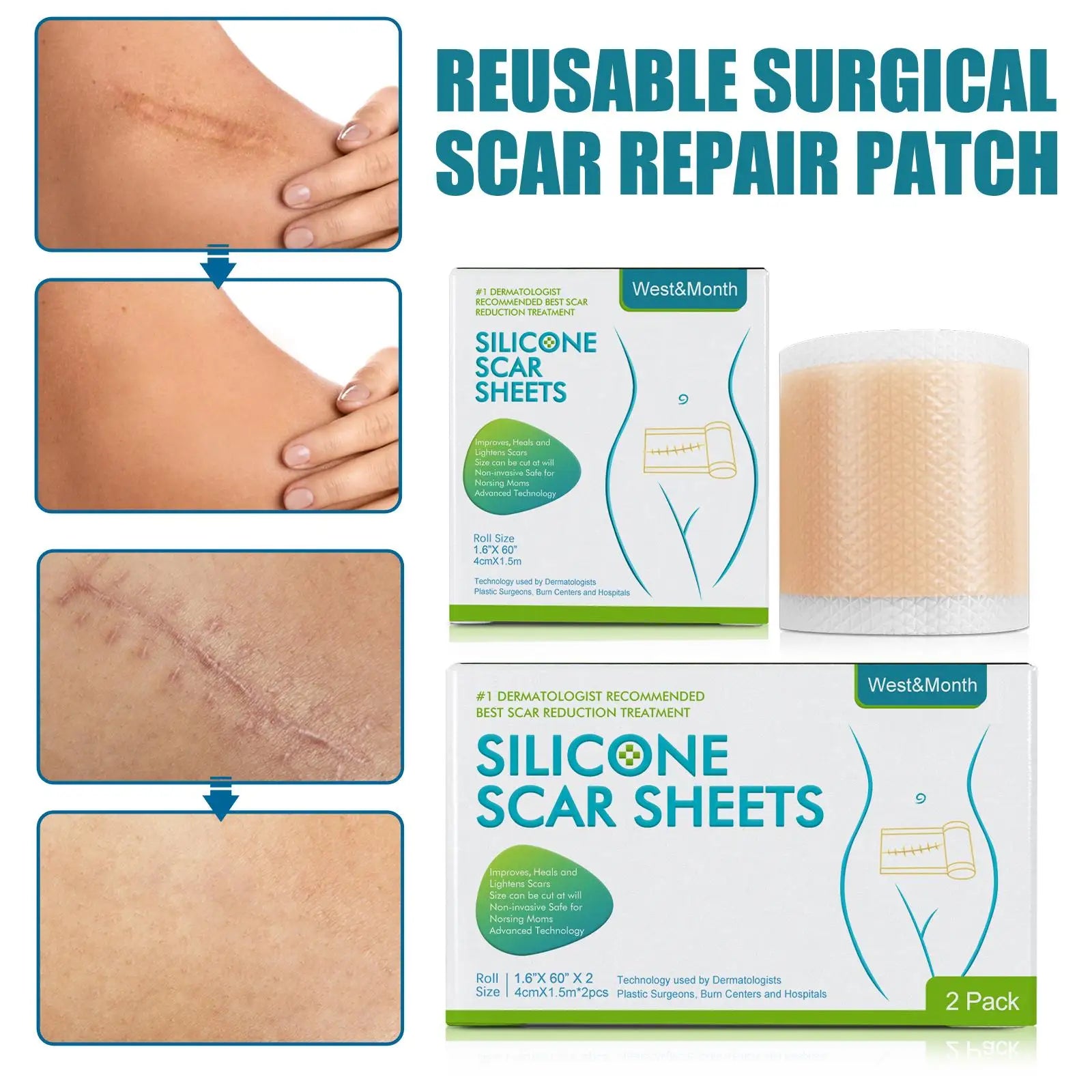 3pcs Silicone Scar Cure Patch Nude Scar Removal Tape 3 Roll Painless Section Keloid Surgery Scars Soft For C-Section Keloids