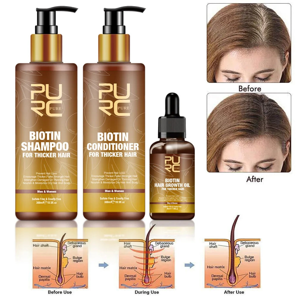 Biotin Hair Growth Shampoo Anti-hair Loss Repair Damaged Curling Oil Scalp Treatment Hair Care Product Shampoo  Hair Wash Unisex