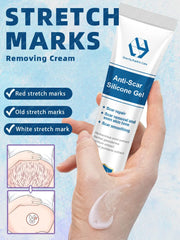 Cream For Pregnancy Stretch Marks Removal Eliminate Red White Old Stretch Marks Oil