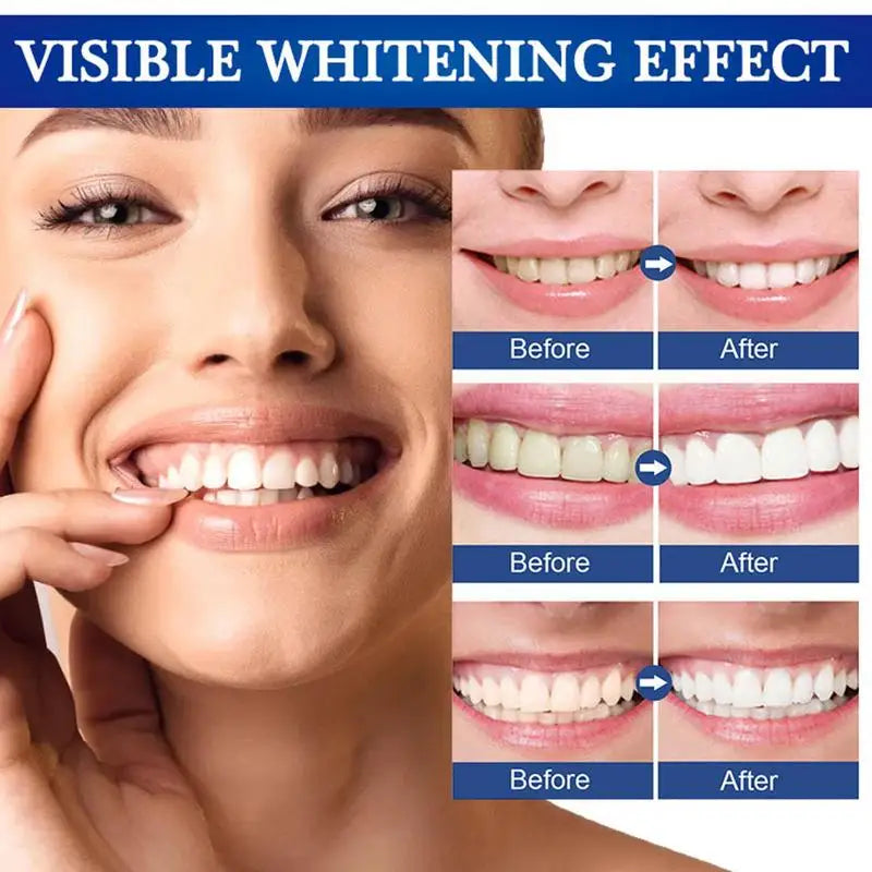 Tooth Whitening Pen Dazzling White Teeth Whitening Pen Instant Teeth Whitening Pen Brighten Your Smile Tooth Hygiene Care Tools