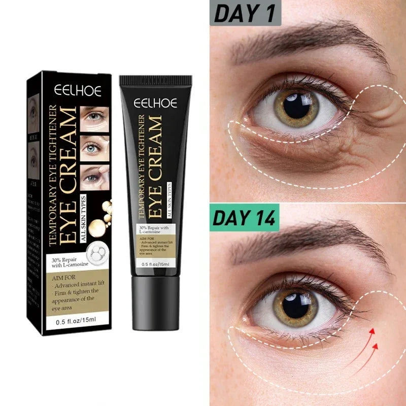 7 Day Tighten Wrinkles Eye Cream Remove Eye Fat Bags Puffiness Lifting Firming Smooth Eye Massage Cream Nourish Eye Skin Care