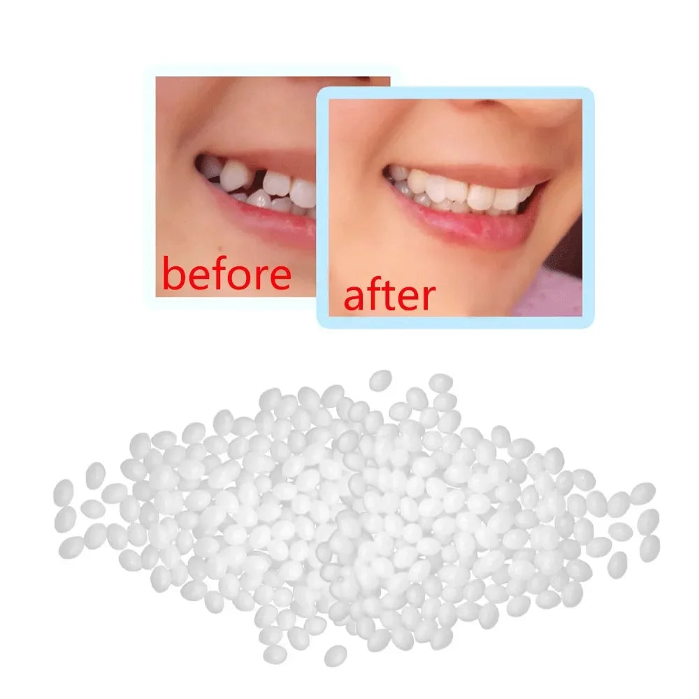 Temporary Tooth Repair Beads Missing Broken Teeth Dental Tooth Filling Material Food Grade FalseTeeth Solid Glue Denture