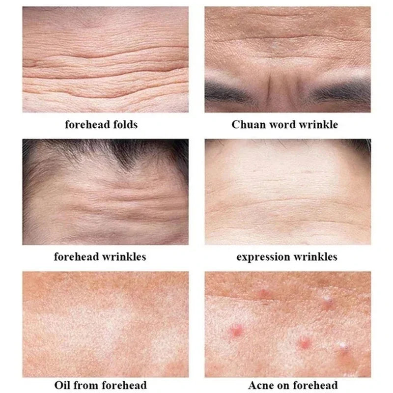 Anti-wrinkle Forehead Line Removal Gel Patch Firming Mask Frown Treatment Stickers Anti-aging Moisturizng Face Skin Care