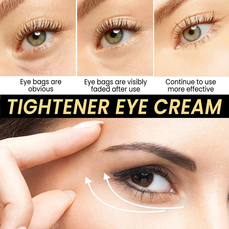 7 Day Tighten Wrinkles Eye Cream Remove Eye Fat Bags Puffiness Lifting Firming Smooth Eye Massage Cream Nourish Eye Skin Care