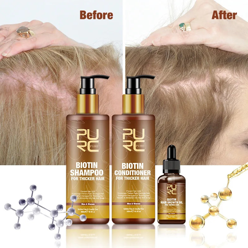 Biotin Hair Growth Shampoo Anti-hair Loss Repair Damaged Curling Oil Scalp Treatment Hair Care Product Shampoo  Hair Wash Unisex