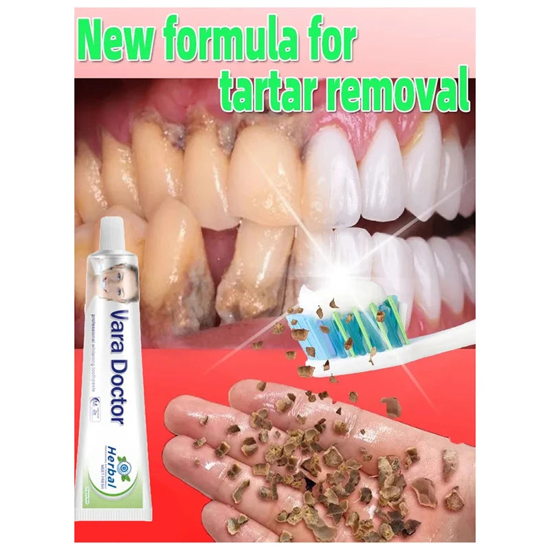 Remover Dental Calculus Whitening Teeth Mouth Odor Removal Bad Breath Preventing Periodontitis 2024 New